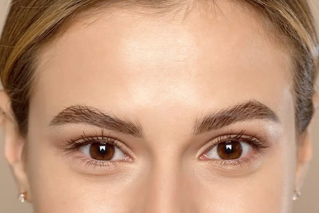 What You Need to Know Before Your Brow Lift
