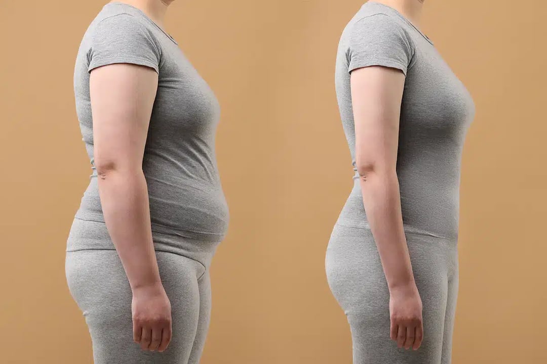 Top Body Procedures That Will Enhance Your Look for the New Year