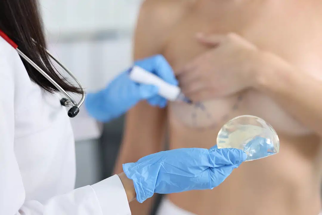 Breast Lift with Implants – Breast Enhancement Plano