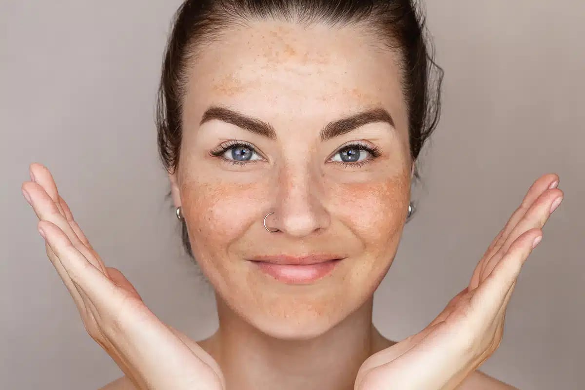 Caucasian woman’s face with freckles or age spots Caucasian woman's face with freckles or age spots