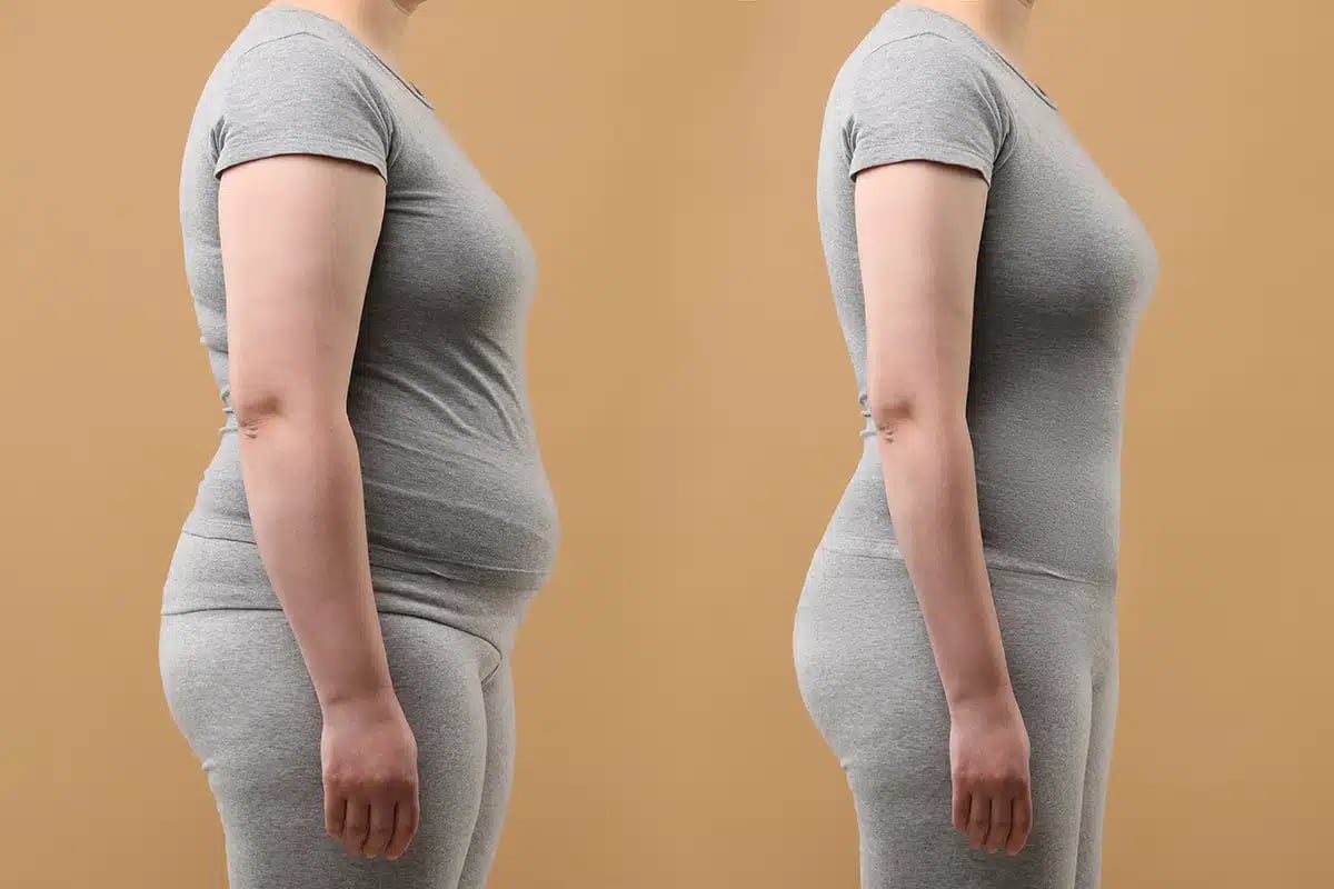 Collage with photos of woman before and after weight loss on beige background