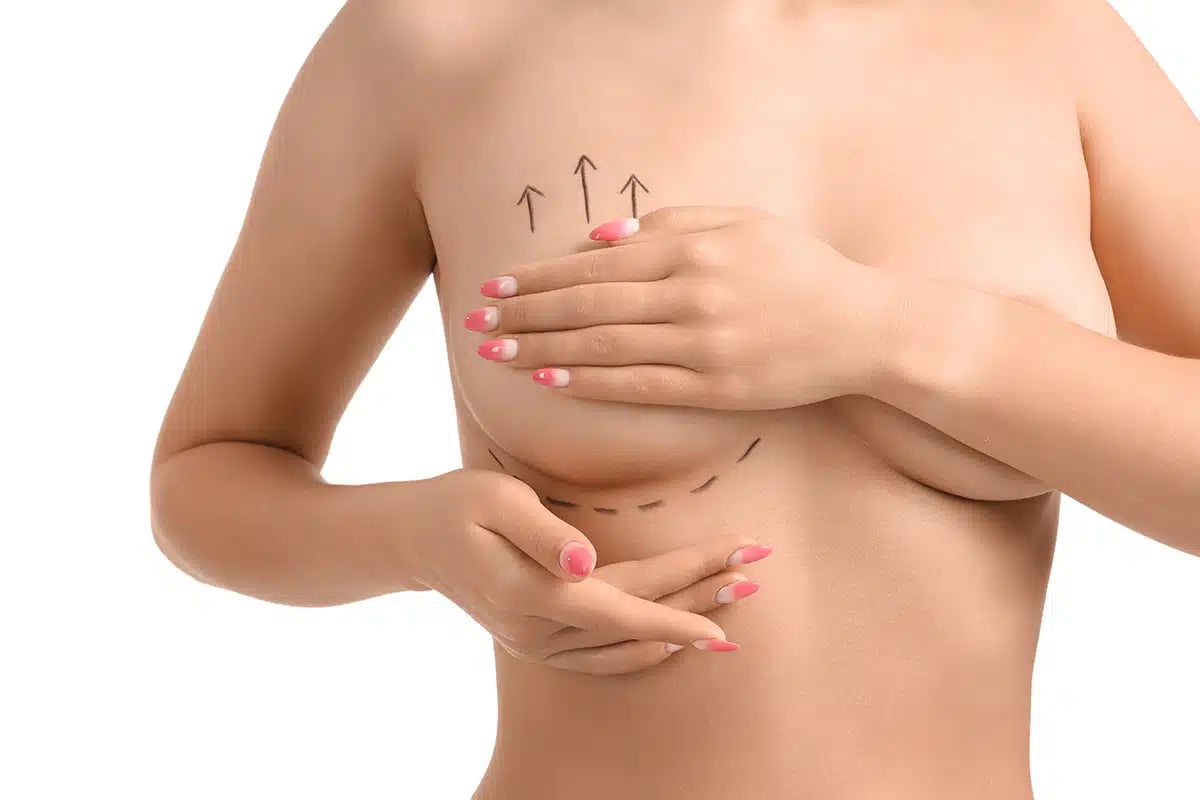 Naked young woman with marks on her breast Naked young woman with marks on her breast