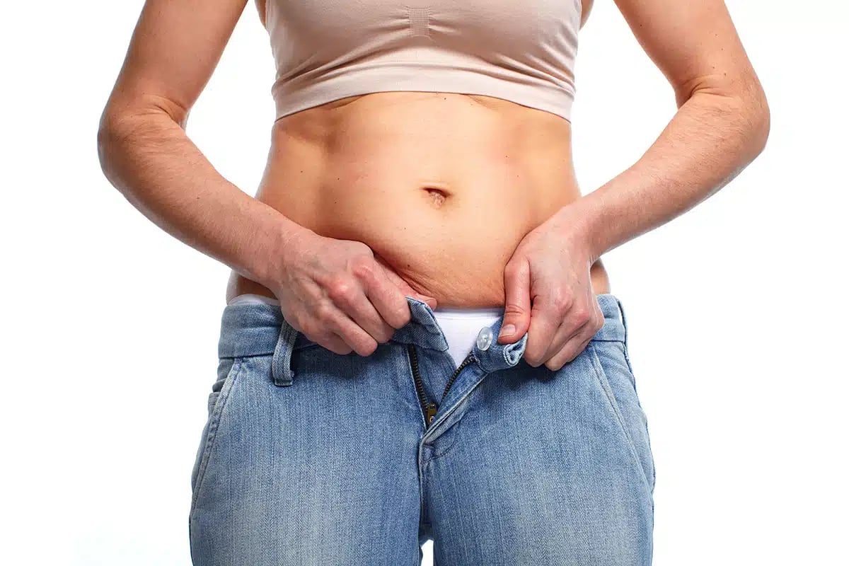 Woman with fat belly