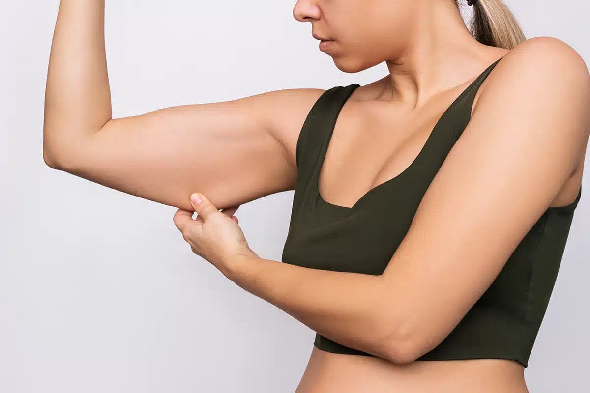 Young Caucasian blonde woman grabbing skin on her upper arm with excess fat